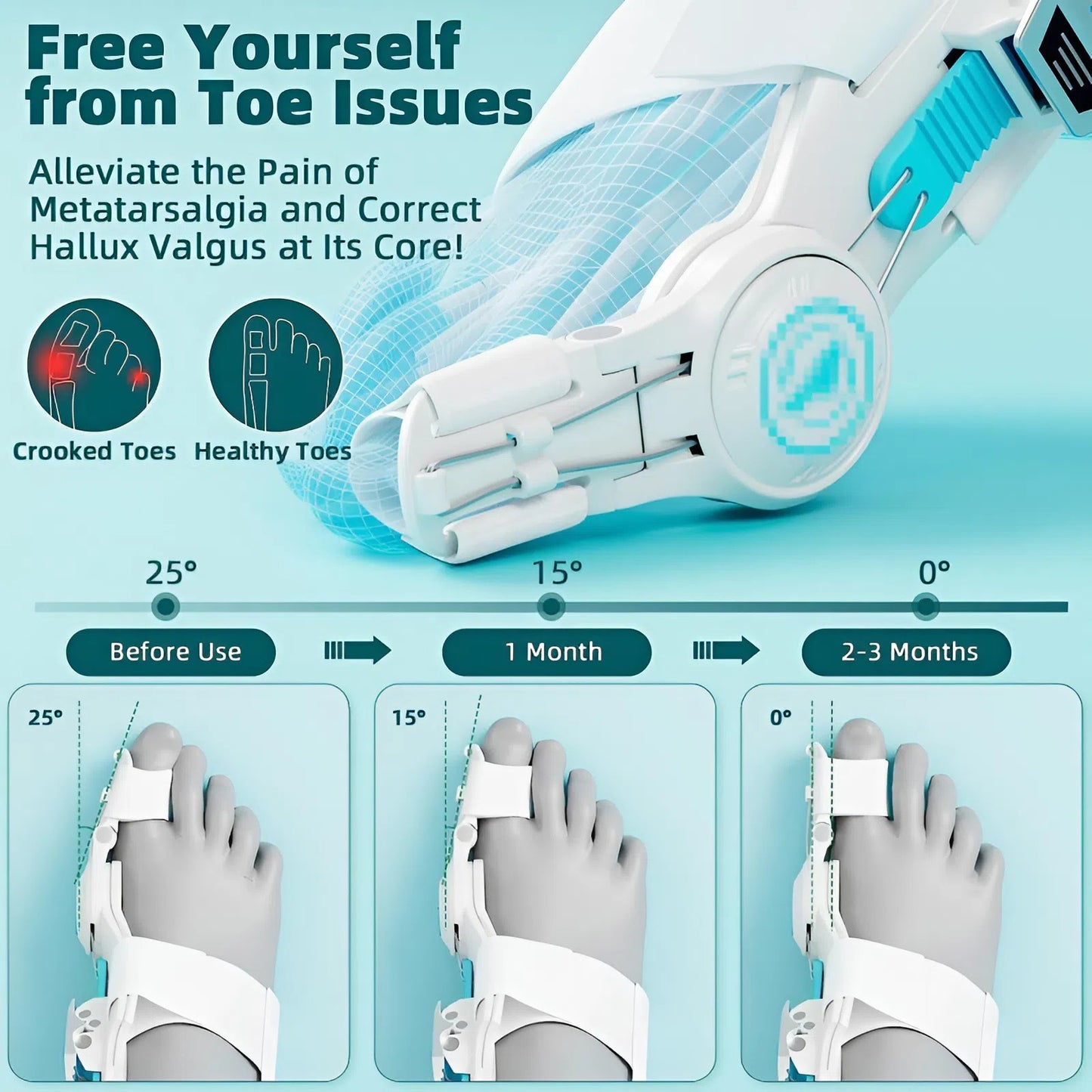 TNF™ Ergo-Pivot Bunion Corrector for Men & Women 🦶 Adjustable Toe Splint with 160° Hinge for Active Use, Hallux Valgus & Hammer Toe Correction